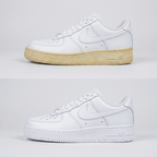 Yellowing Treatment – Sole Whitening